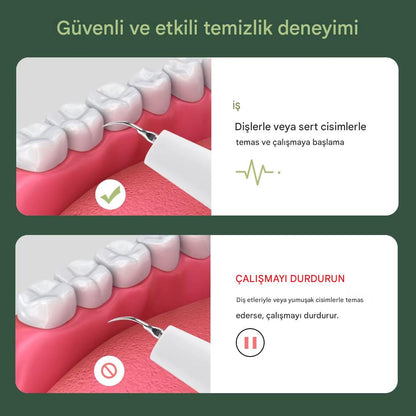 teknixy™ Akıllı Kameralı Ultrasonik Diş Taşı Temizleyici & Leke Giderici (+700 TL Değerinde Set HEDİYE!)